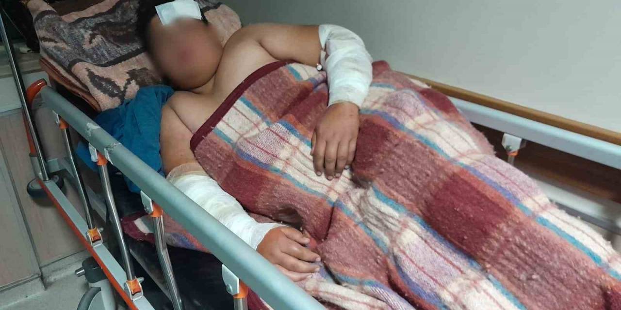 Konya’da Köpeklerin Kovaladığı Çocuk Bisikletten Düşüp Yaralandı