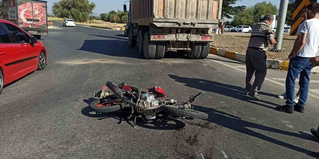 Kazada Yaralanan Motosiklet Sürücüsü Hayata Tutunamadı