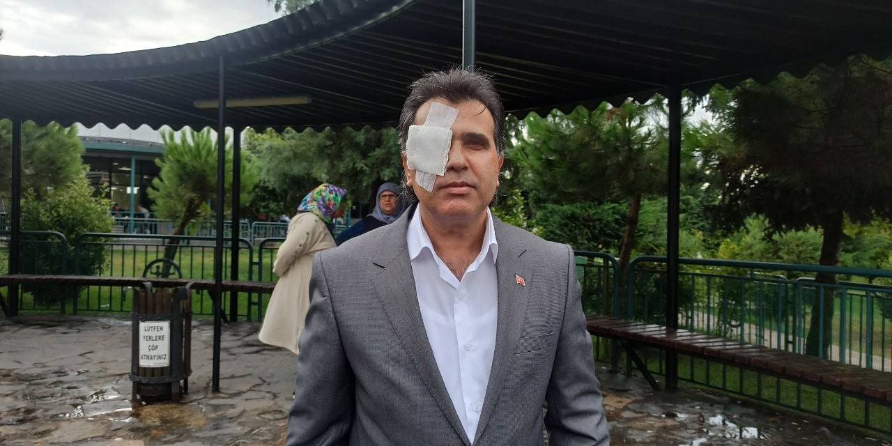 Sağ Gözünde Yüzde 60 Görme Kaybı Oluştu, Yine De Şikayetçi Olmadı