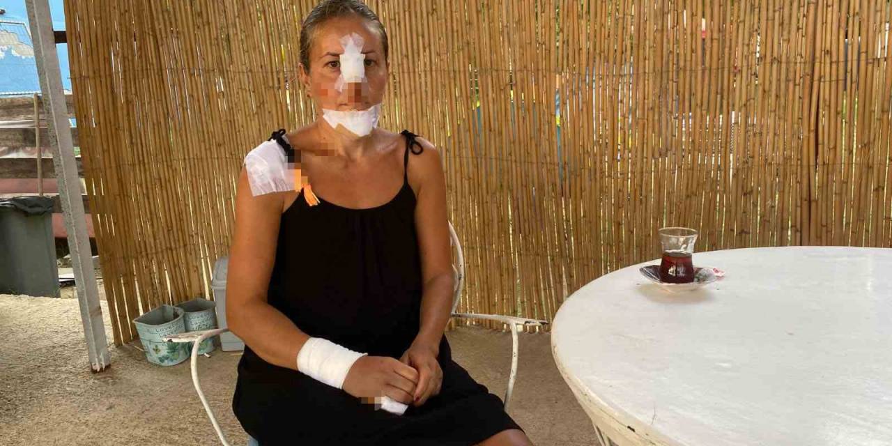 Erdek’te Köpeklerinin Saldırısına Uğrayan Kadın Ve Kızı Scooterdan Düştü