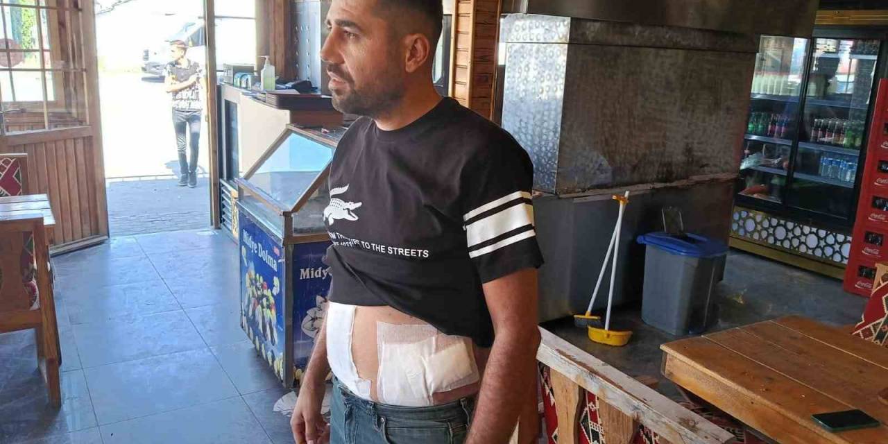Yoldan Geçen Kadına Laf Atanlara Tepki Gösterince Karnından Bıçaklandı