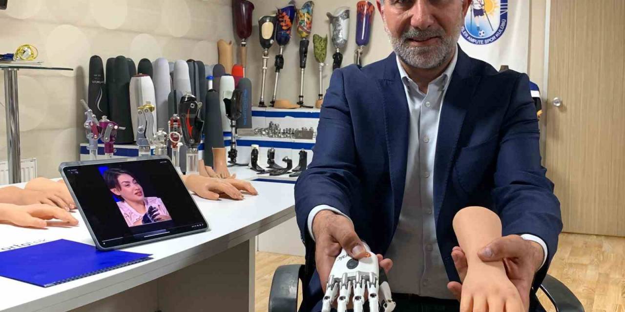 Yarışmadan 1 Milyon Lira Kazanan Rabia’nın Protezini İş Adamı Karşılayacak