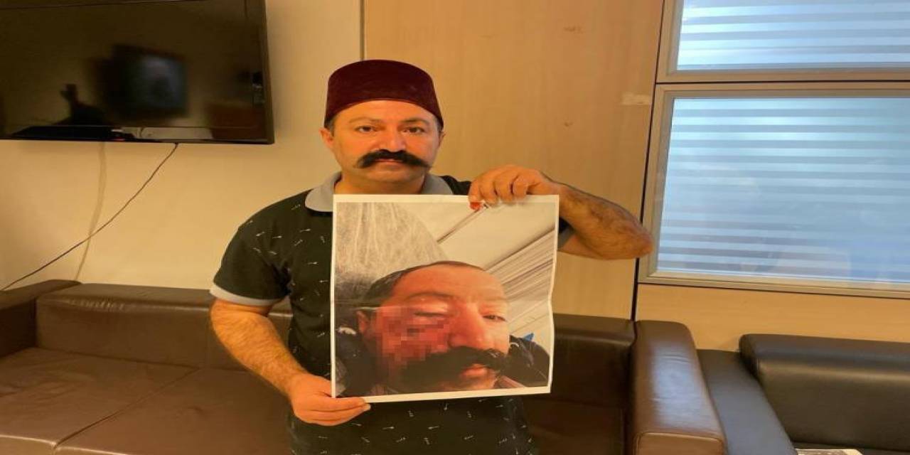 Sosyal Medya Fenomeni, Ev Sahibi Tarafından Darp Edildiğini İddia Etti