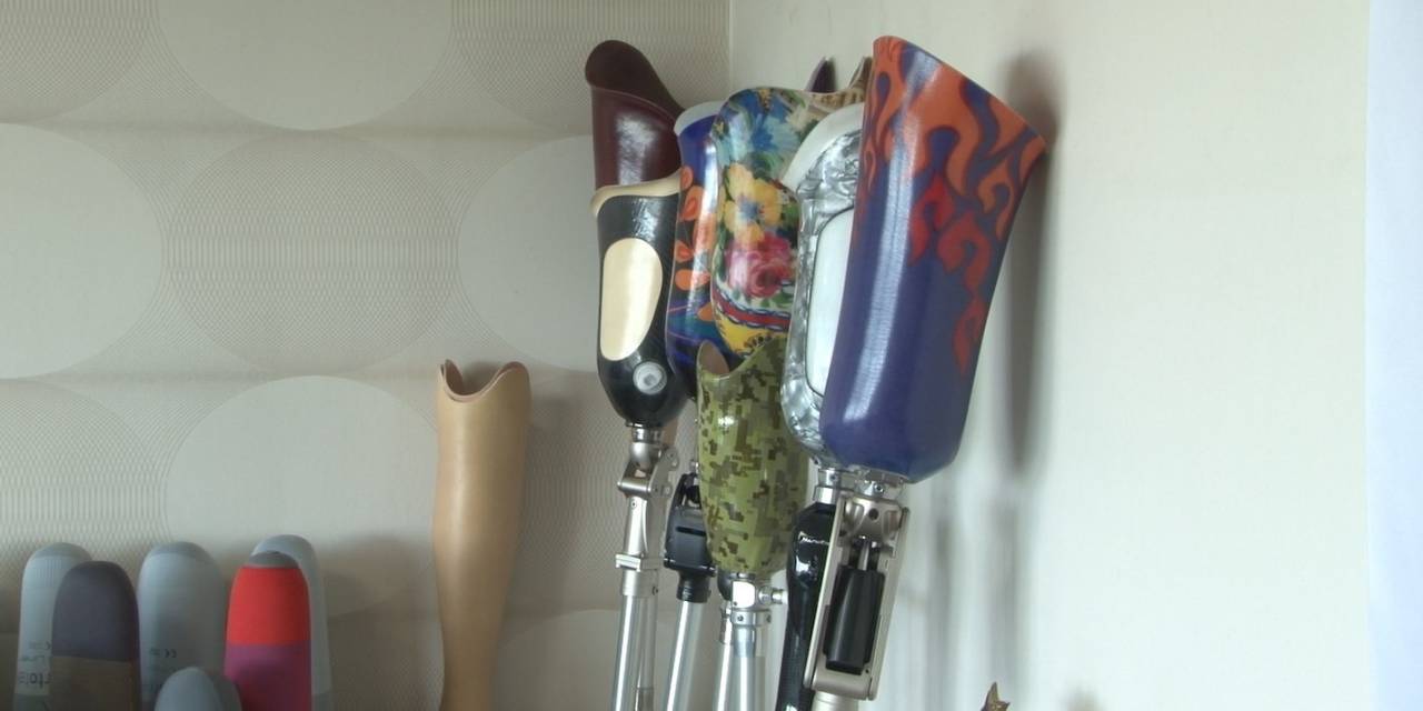 Kırşehirli İş Adamı Düger, 20 Depremzedeye Ücretsiz Protez Temini Gerçekleştirdi