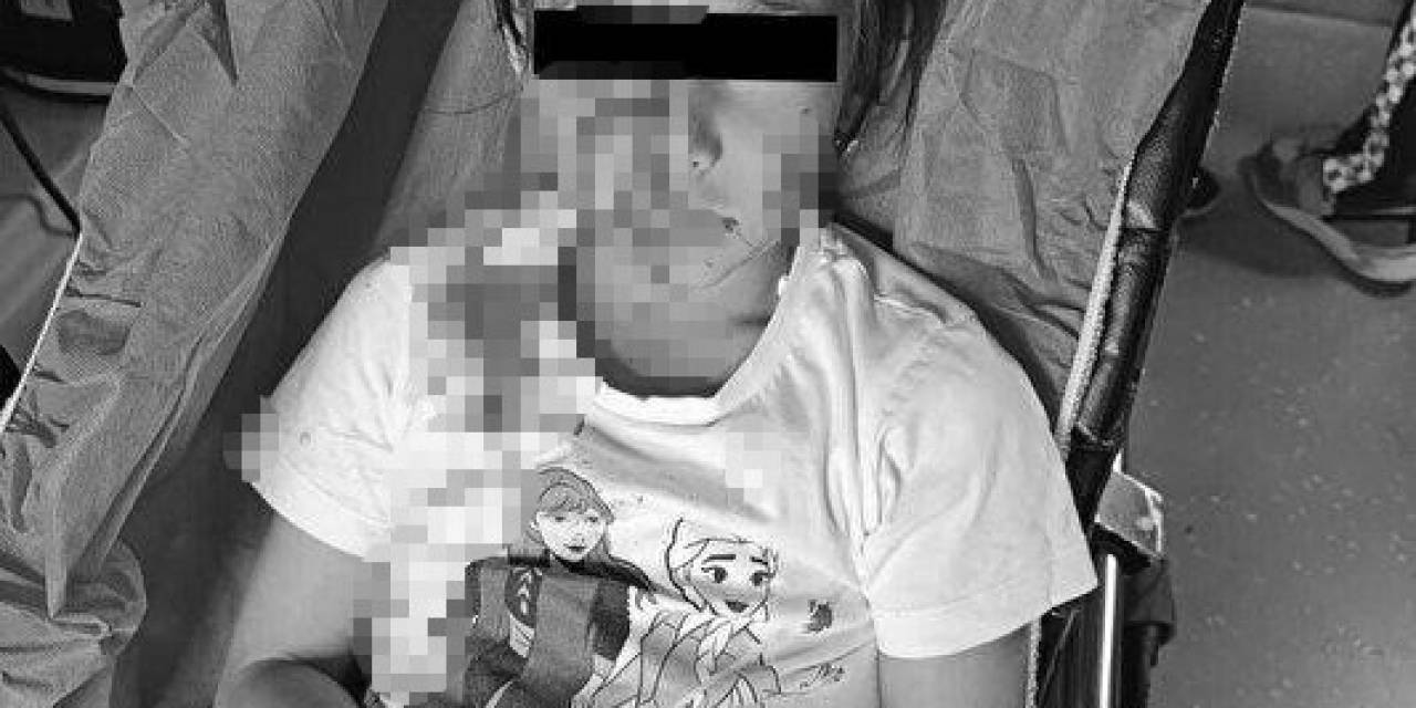 Esenyurt’ta Başıboş Köpek Dehşeti: Site Bahçesinde Oynayan Kıza Saldırdı
