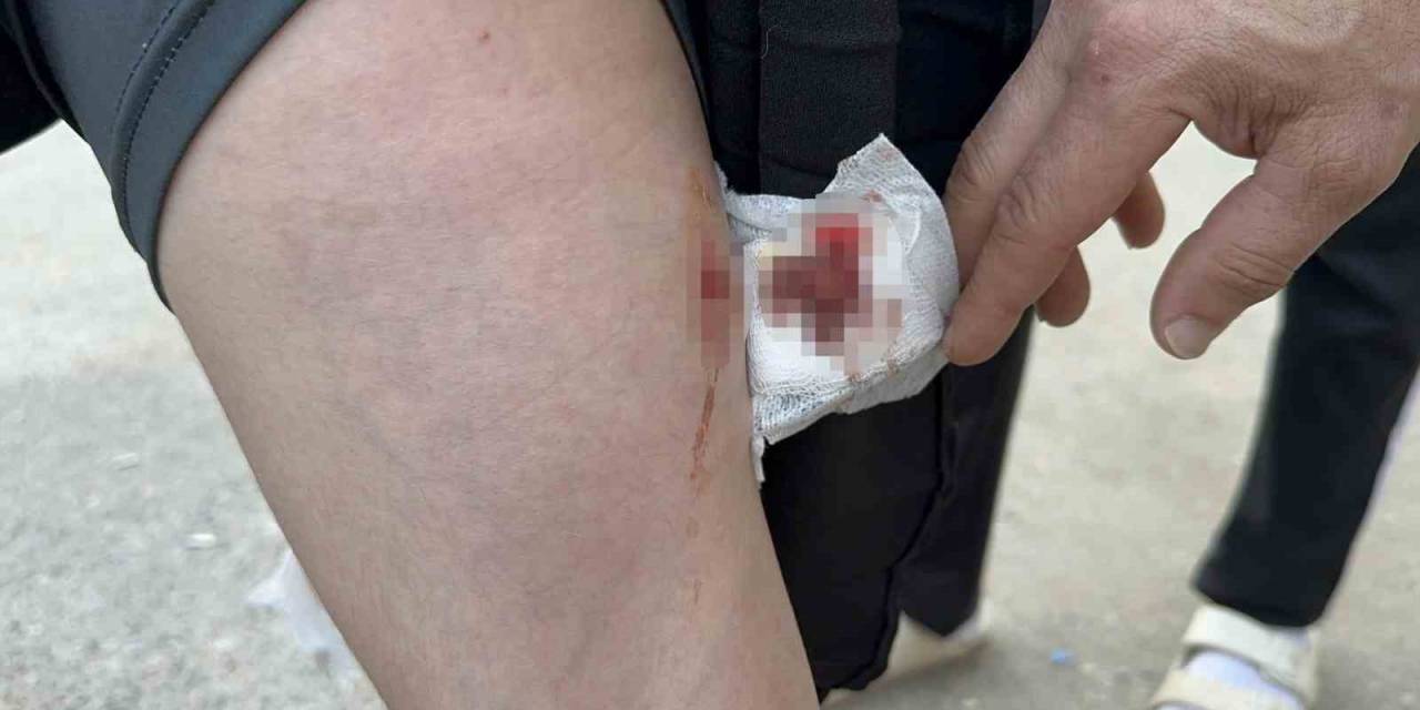 Okula Giderken Sokak Köpeğinin Saldırısına Uğradı