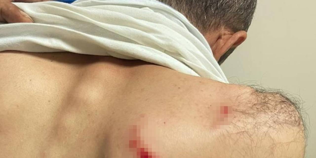 Siirt’te Enerji Şirketi Saha Ekibine Saldırıda 2 Personel Yaralandı