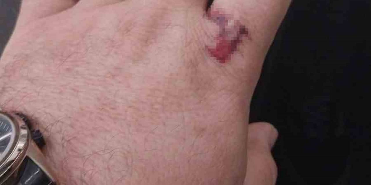 Duruşmanın Bitmesini Beklediler, Takip Ettikleri Yakını Öldürülen Adamı Darp Ettiler