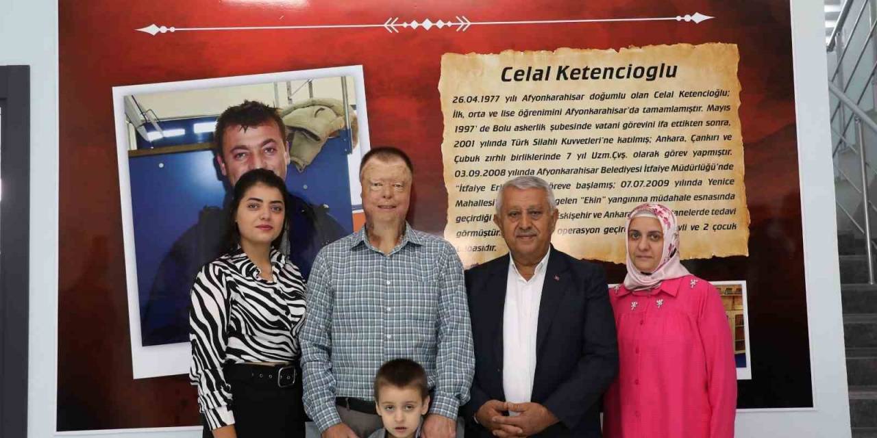 Başkan Zeybek’ten Yaralanan İtfaiye Erine Büyük Vefa