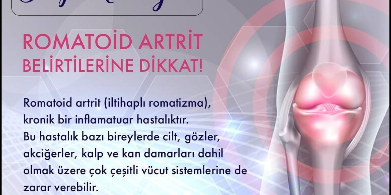 Bilge’den Dünya Artrit Günü Açıklaması