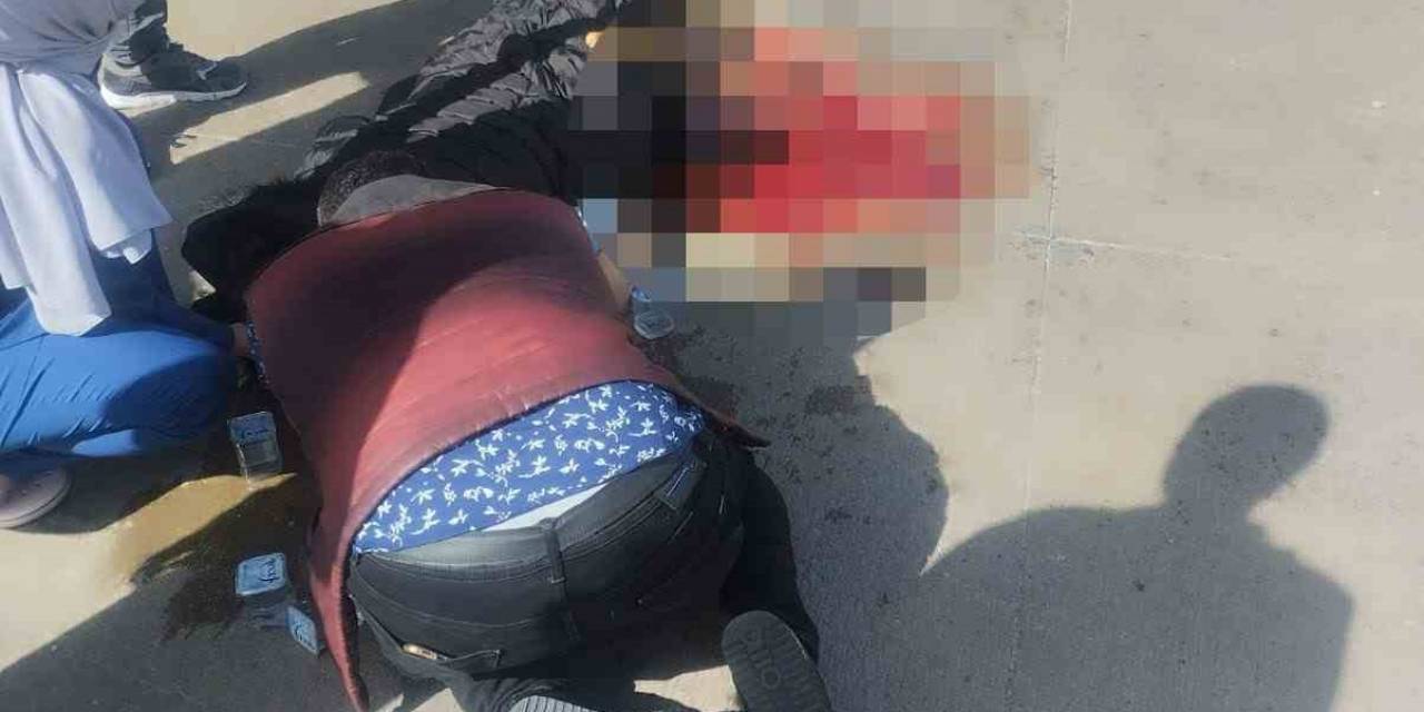 Otobüsün Altında Kalan Hamile Kadının Bacağı Koptu