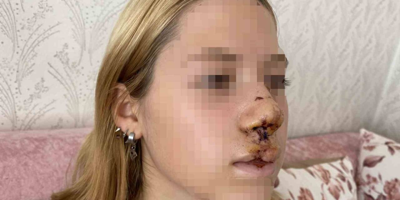 Lise Öğrencisi Kızın Suratına Attığı Taşla Dişlerinin Kırılmasına Neden Olan Gencin Yargılanmasına Başlanıldı