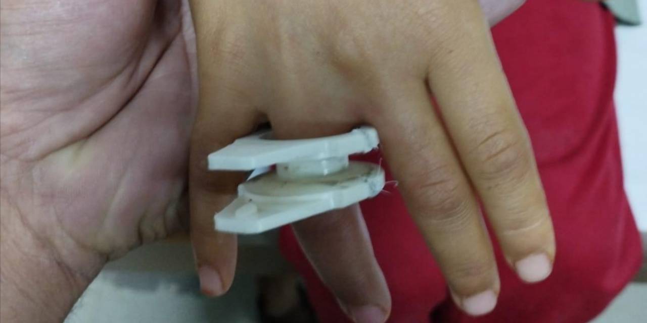 Parmağına Plastik Parçası Sıkışan Çocuğu İtfaiye Kurtardı