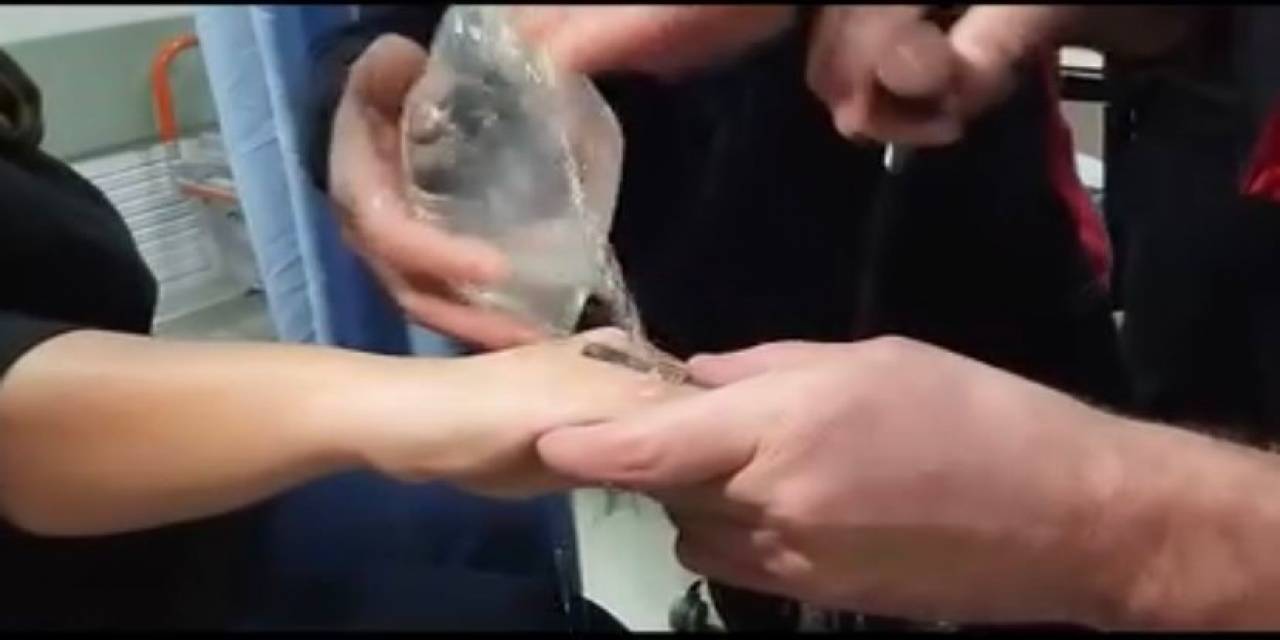 Elazığ’da Parmağa Sıkışan Yüzüğü İtfaiye Ekipleri Çıkardı