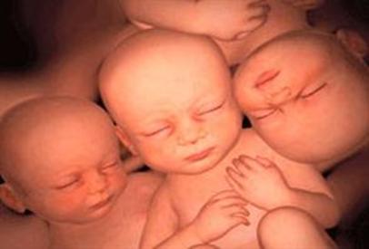 "Çoğul gebeliklerde artış var"