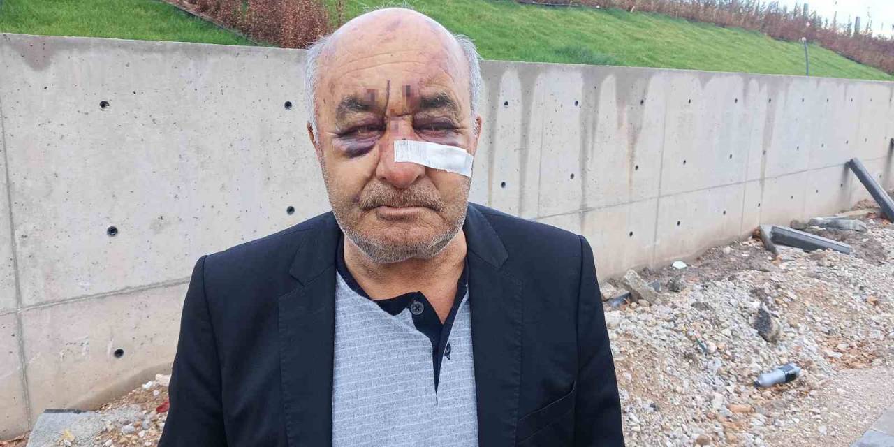 Öldüresiye Dövülen Taksici Korku Dolu O Anları Anlattı