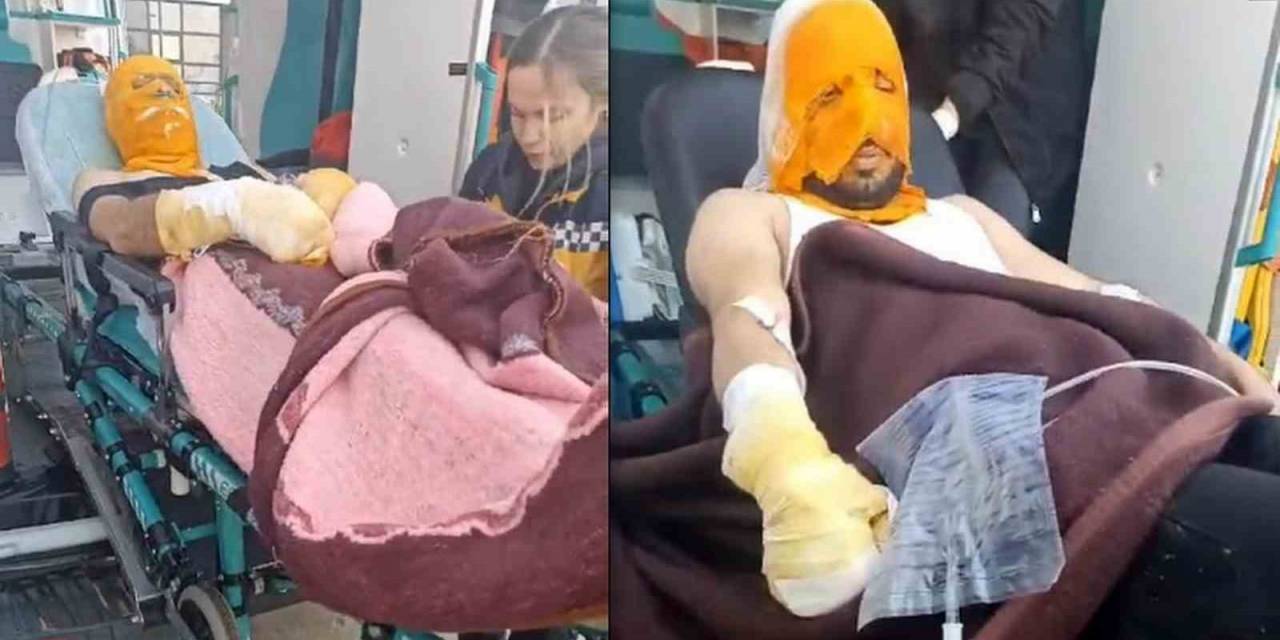 Erzincan’da Trafo Patlaması Sonucu 2 Aras Edaş Personeli Yaralandı