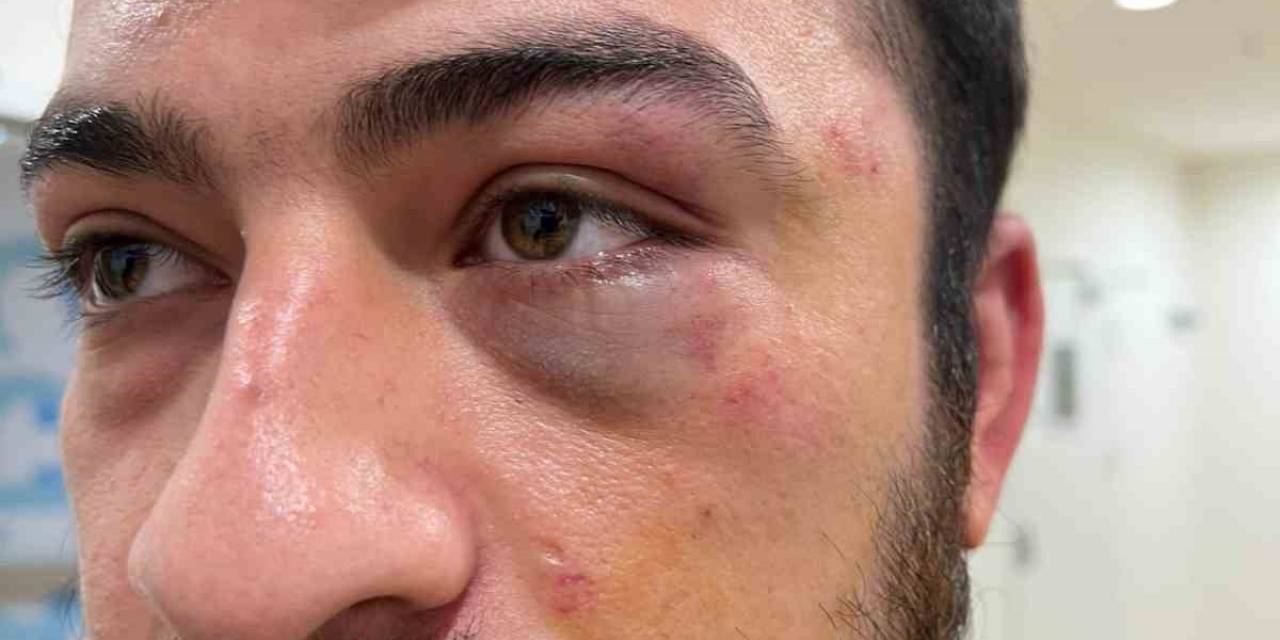 Şişli’de Hemşir İle Hasta Arasında "Eldiveni Değiştir" Kavgası: 3 Gözaltı