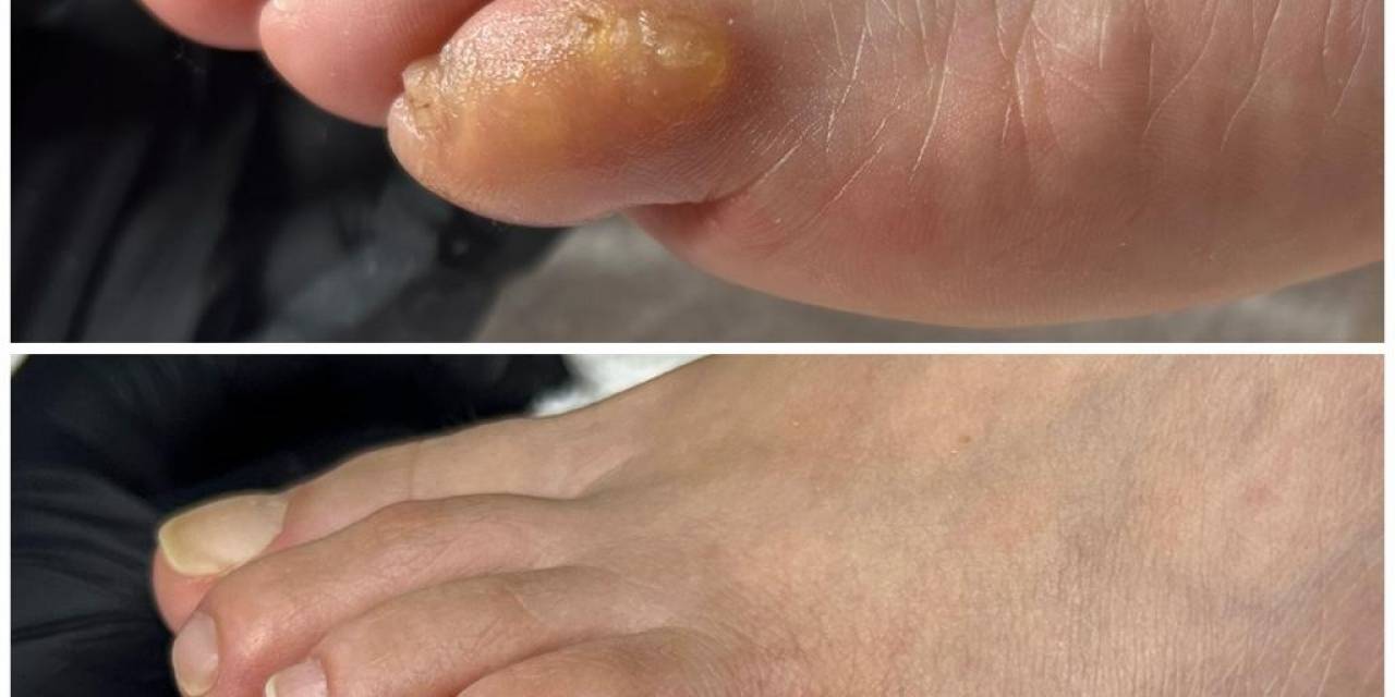 Tırnak Bakımına Dikkat