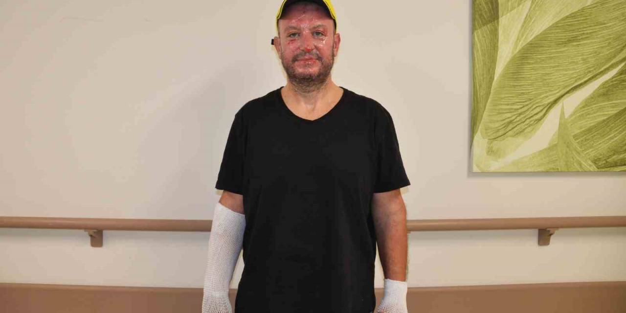 Oksijen Tüpünün Patlaması Sonucu Yaralanan Amca Ve Yeğeni Sağlığına Kavuştu