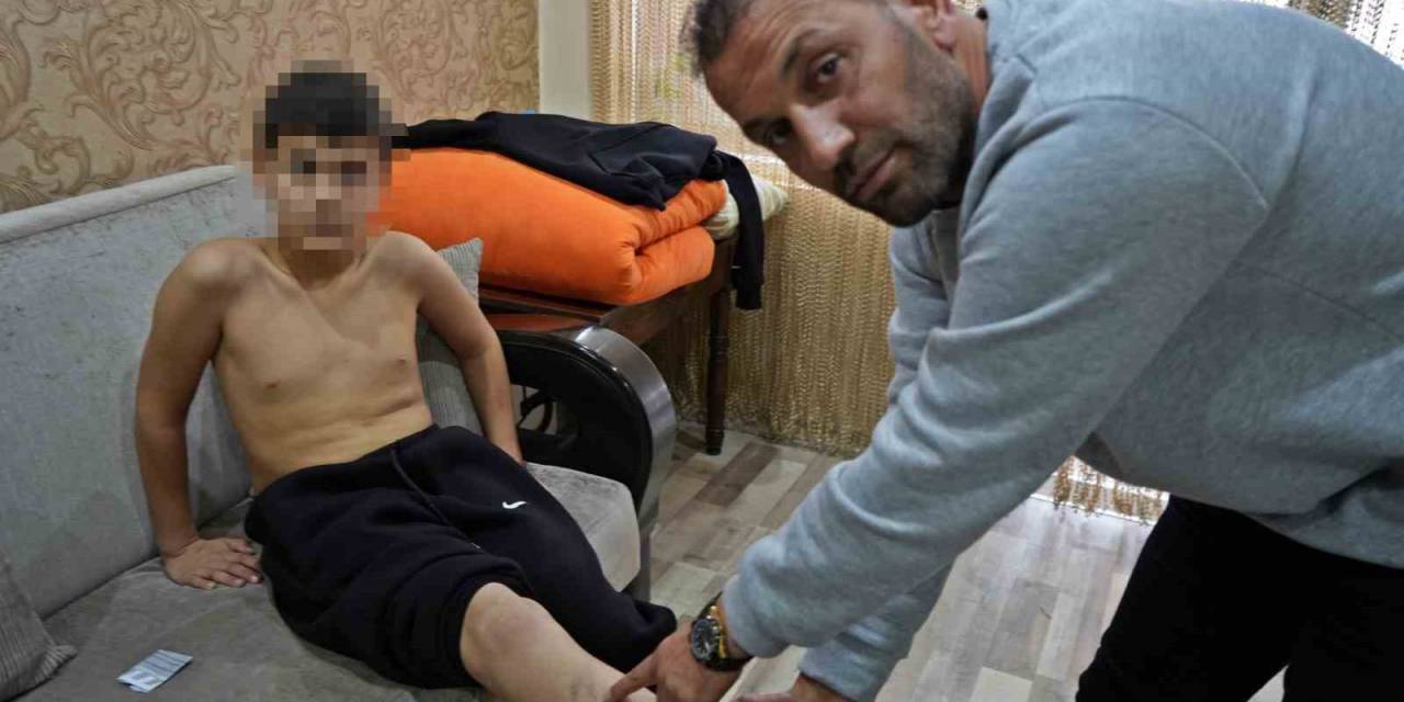 Ailesinin ‘Kavga Etme, Şikayet Gelmesin’ Sözüyle Akranlarının Zorbalığını 2 Ay Boyunca Sakladı