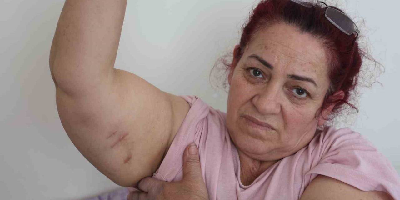 Köpeklerin Saldırısına Uğrayan Kadın: “Ben O An Öldüğümü Sandım”