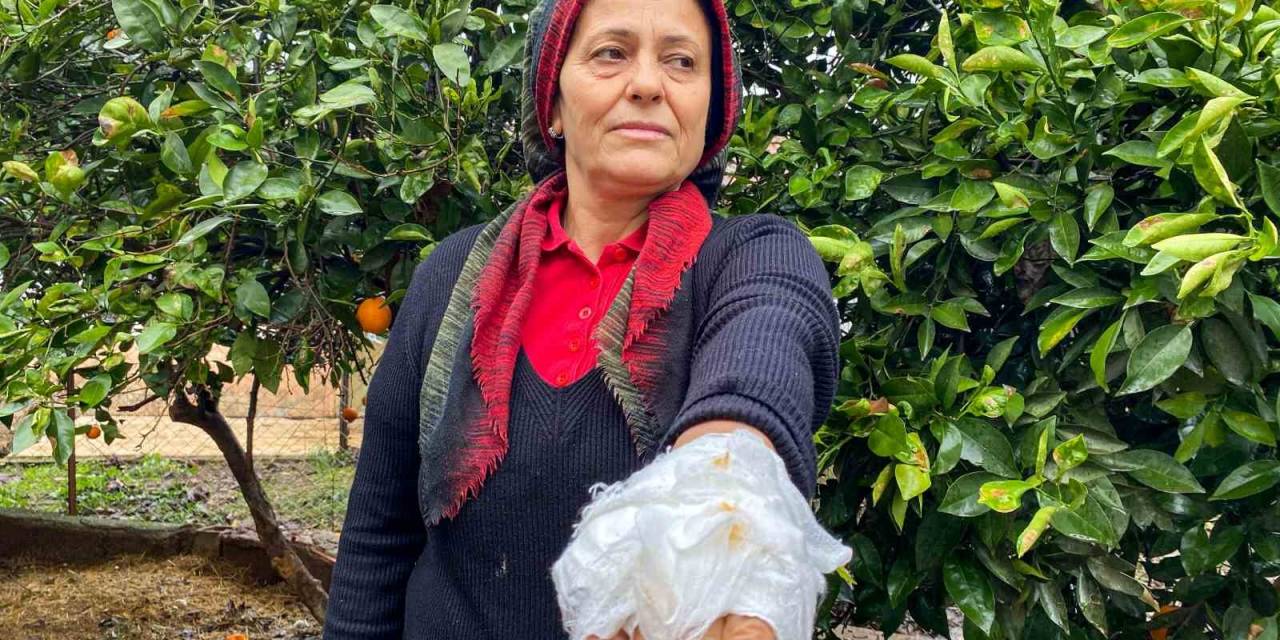 Yumurta Toplamak İçin Bahçeye Giren Kadın, Dobermanın Saldırısına Uğradı