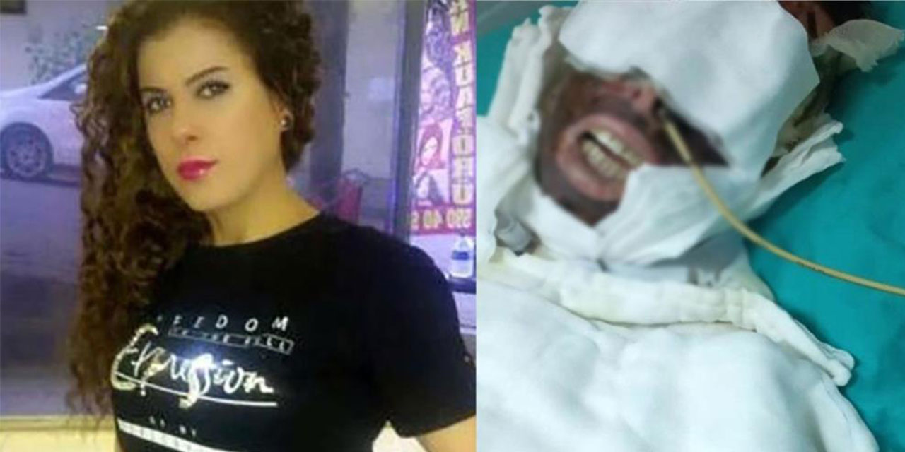 Aşık Olduğu Kadına Gizlice Girdiği Evinde Kimyasal Madde İle Saldıran Sanığa 20 Yıl Hapis