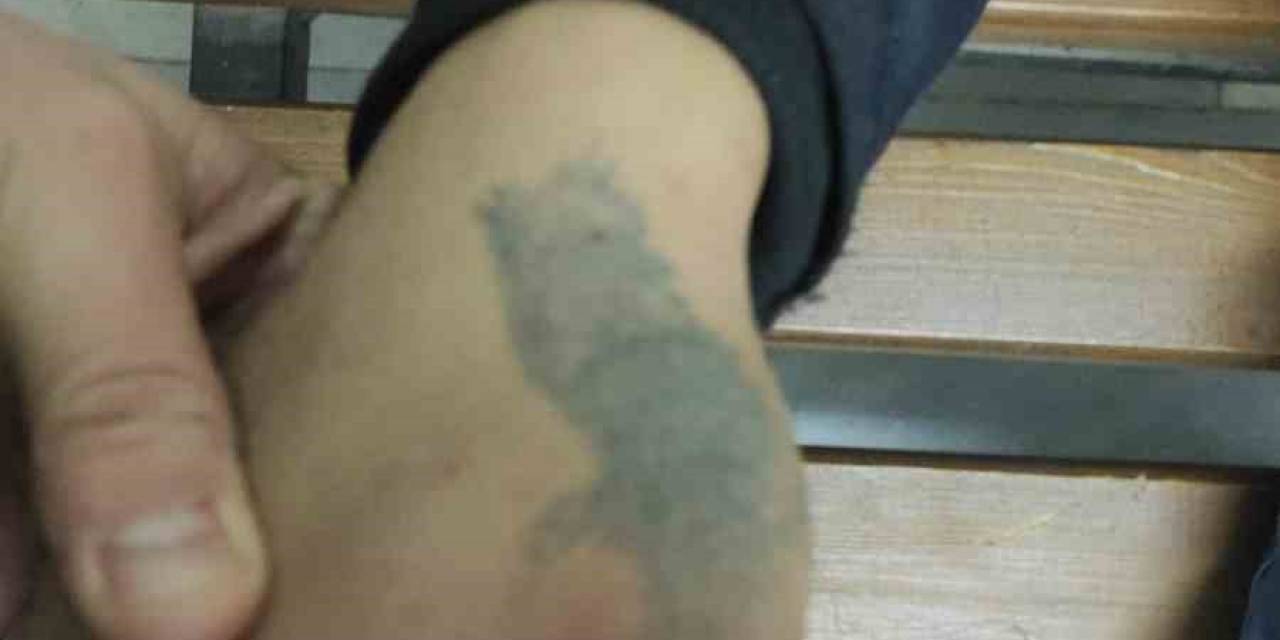 Azılı Hırsız Elindeki Dövmeden Yakalandı