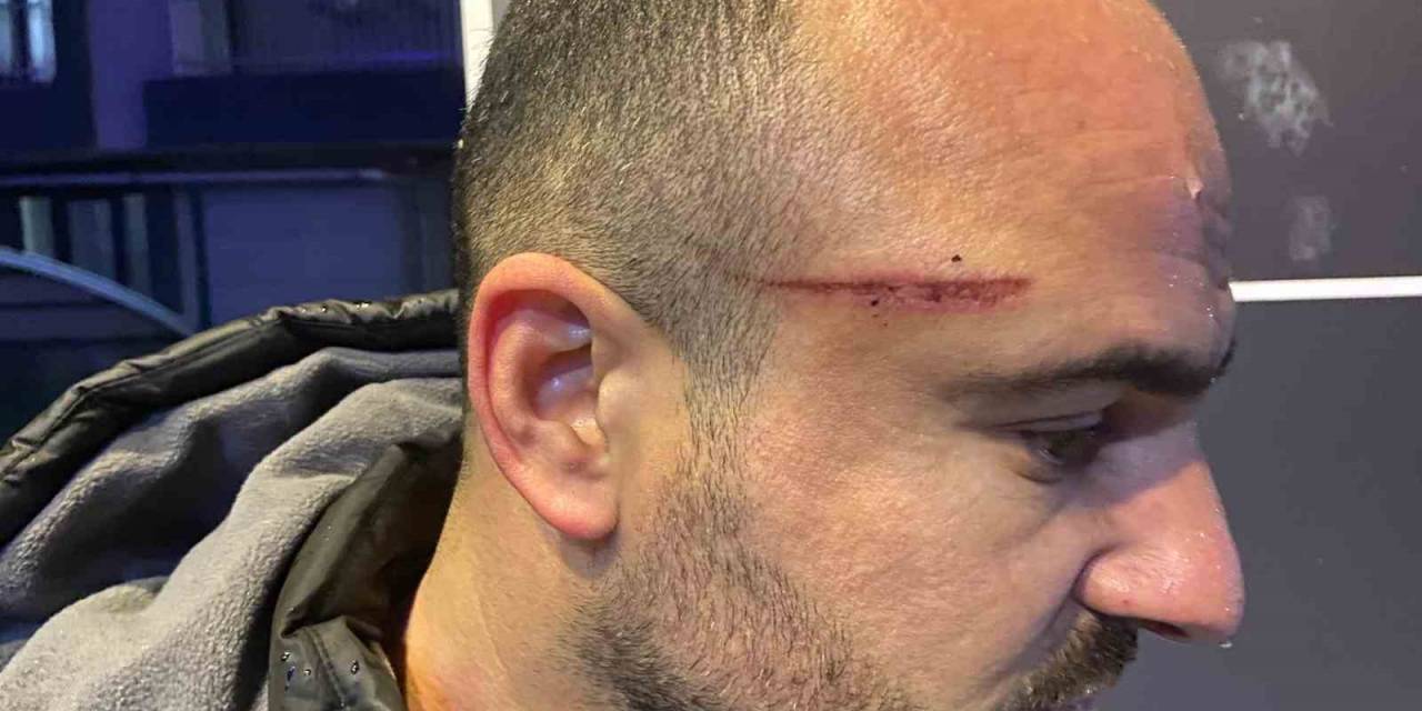 İşe Gitmek İçin Otomobiline Bindi, Dehşeti Yaşadı