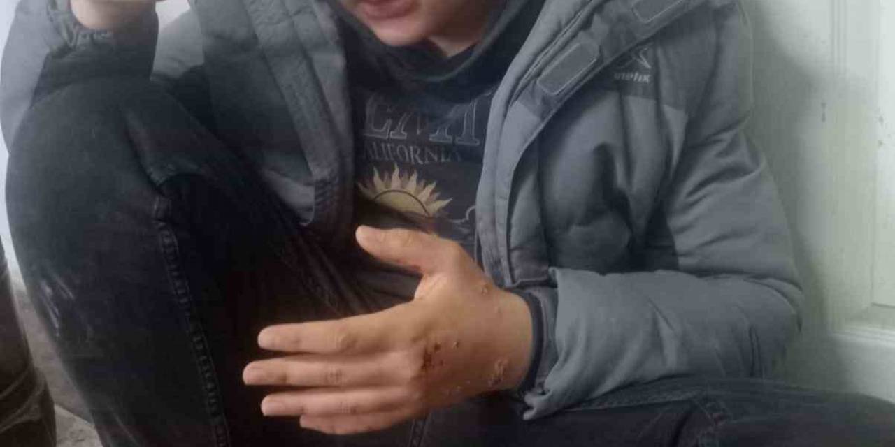 Deprem Paniğiyle Evin Balkonundan Atlayan Çocuk Yaralandı