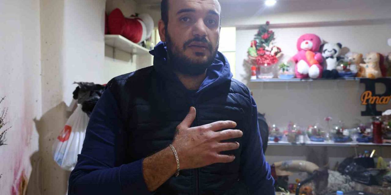 Tüm Yıl Bu Günü Beklemişti, Helyum Dolu Balonların Ampule Temas Etmesiyle Çıkan Yangında Yaralandı