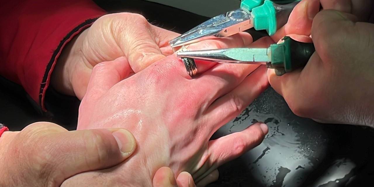 Parmağına Yüzük Sıkışan Vatandaşı İtfaiye Kurtardı