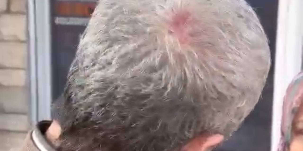 Maltepe’de Broşür Dağıtan Ak Partili’yi Darp Etmişlerdi, 6 Kişi Gözaltına Alındı