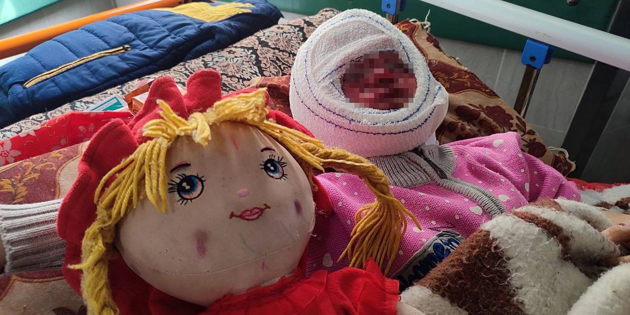 İsrail’in Saldırılarında Yüzü Yanan 4 Yaşındaki Seca, Tedavi İçin Bekliyor