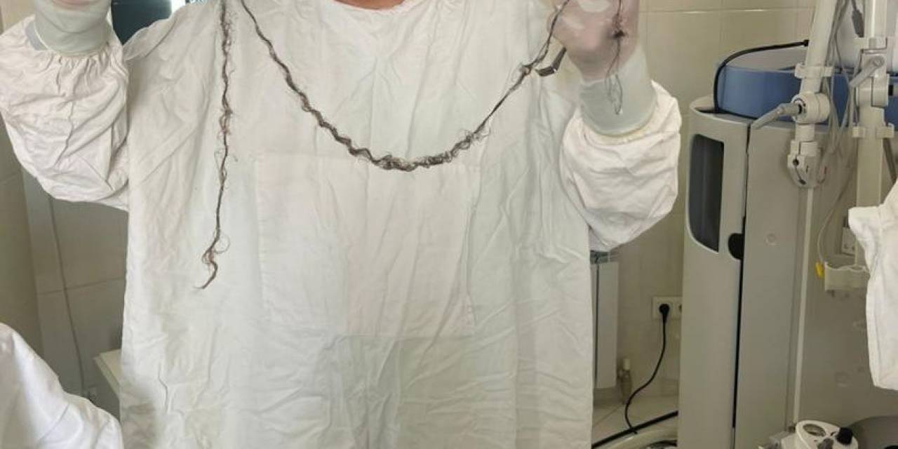 Kırgızistanlı Çocuğun Beyninden Saç Çıktı