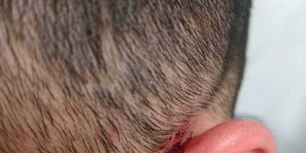 Diyarbakır Ve Şırnak’ta Kaçak Elektrik Kullanımına Hapis Cezası