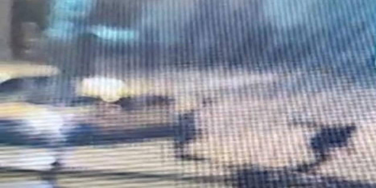 Yumruk Darbeleri Alan Seyis 97 Gün Sonra Öldü