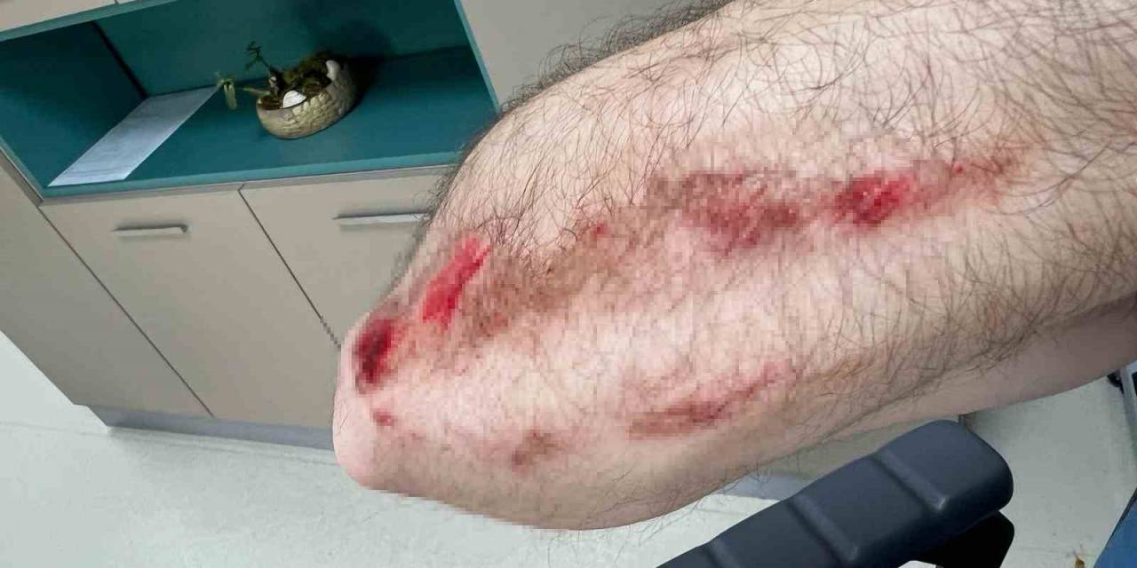 Üsküdar’da Site Sakinleri İle Yöneticileri Arasında Kavga Kamerada