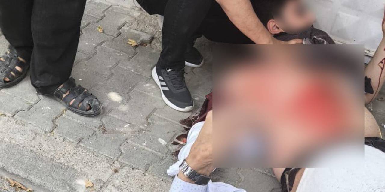 Sokak Ortasında Bıçaklandı