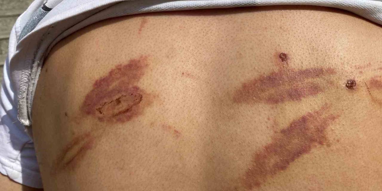 Öldüresiye Darp Edilmişti, Yaşadıklarını Anlattı