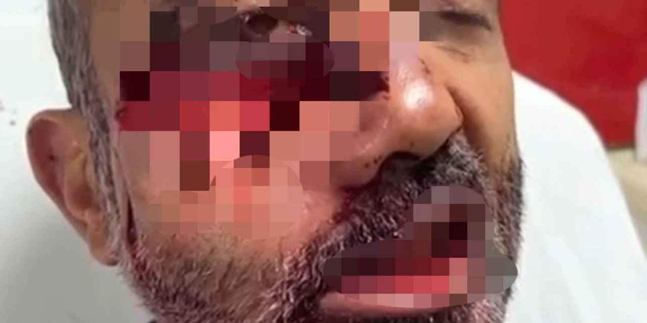 Hakkari’de Tarlasına Gitti İki Ayının Saldırısına Uğradı