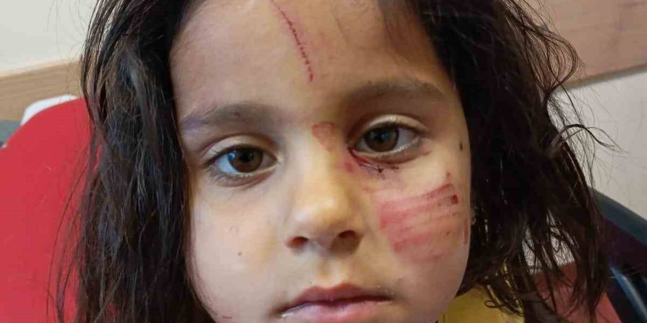 Başıboş Köpeklerin Saldırısına Uğrayan Çocuk Yaralandı