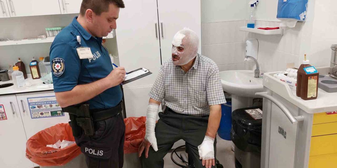 Tenceredeki Kızgın Yağa Su Dökünce Yanarak Hastanelik Oldu