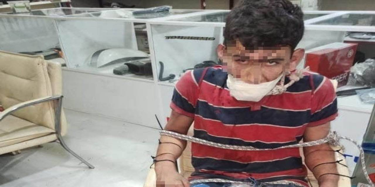 İşkence Yapıp Böcek Yedirdiler, Kerpetenle Dişlerini Söktüler