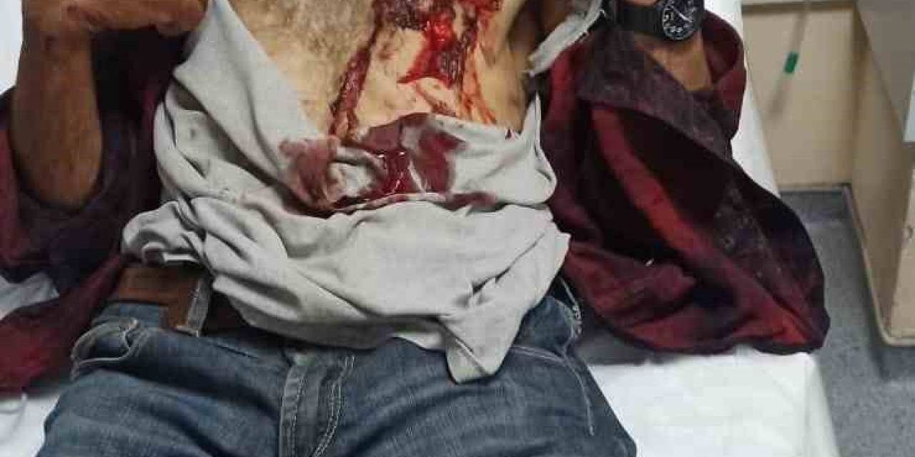 Hayvanlarını Otlatırken Yaban Domuzunun Saldırısına Uğradı