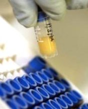 HIV için yeni bir umut