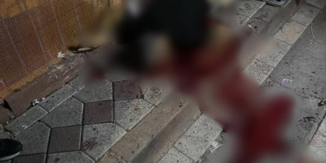 Sultangazi’de Silahlı Saldırıya Uğrayan Kuyumcu Hayatını Kaybetti