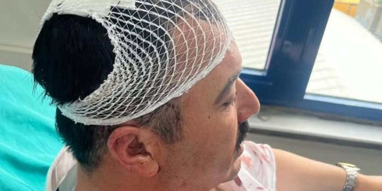 Yeniden Refah Partili Başkan Yardımcısı, Belediye Başkan Yardımcısının Kafasına Şekerlikle Vurdu