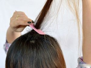 Saç Kaybı, Hem İş Hem Sosyal Hayatı Etkiliyor